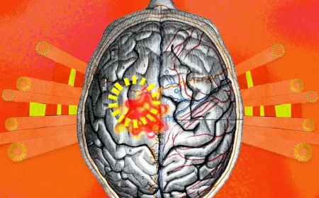 تغییرات اقلیمی سلامت مغز را تهدید میکند؛ هشدار پزشکان درباره خطرات پنهان گرمایش زمین
